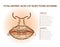 Hyaluronic acid filler. Lip injections. Lip anatomy poster