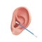 Hygiene of the ear canal with a cotton swab. Vector realistic illustration of cleaning the human ear from earwax close up isolated