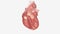 Hypertrophic cardiomyopathy occurs when the muscle cells of the heart enlarge causing the walls of ventricles to thicken