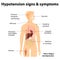 Hypotension signs & symptoms