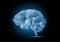 Illustartion of human brain polygon on black background