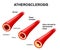 Illustrates the progression of atherosclerosis in CVD patients.