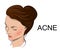 Illustration of acne
