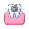 Illustration of dental braces. Dentistry and health care icon. Stomatology medical item.