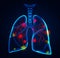 Illustration of human lungs affected with disease on background