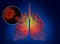 Illustration of human lungs affected with disease on background