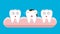 Illustration of tooth sectional view decay with caries dental health problem