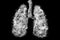 Illustration of a toxic smoke in Lung . lung cancer concept