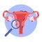 Illustration of the uterus and endometriosis. Womens diseases. Gynecological examination and prevention of womens health