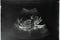 Image of mother`s womb ultrasound during pregnancy. Ultrasound of a fetus at 12 weeks 6 days