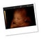 Image of newborn baby like 3D ultrasound of baby in mother\'s wom