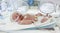 Image of the premature baby in incubator