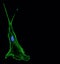 Immunofluorescence confocal imaging of a single invasive lung cancer cell