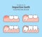 Impaction tooth illustration vector on blue background. Dental