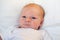 Infant acne, allergy, atopic dermatitis