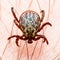 Infectious Encephalitis Tick Insect on Skin. Encephalitis Virus or Lyme Borreliosis Disease Infected Dermacentor Tick Arachnid