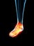 Inflamed ligaments