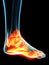 Inflamed ligaments
