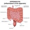 Inflammation of the appendix