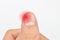 Inflammation at the tip of fingernail. Concept of paronychia at thumb of Asian man. Painful finger