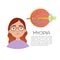 Infografica eyes disease