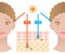 Infographic illustration of difference between UVA and UVB rays.  UV penetration into human skin and woman face. skin care and