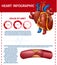 Infographic Realistic Heart and Blocked Fat Vessel