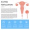 Infographic in vitro fertilization