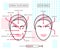 Infograthic poster about dermal fillers and botox ares. Injections. Cosmetology. Beauty. Vector Illustration.