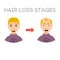 Information chart of hair loss stages types of baldness illustrated on male head vector.