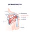 infraspinatus muscle and bone skeletal structure in shoulder outline diagram