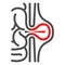 Inguinal hernia line icon, Human diseases concept, hernia sign on white background, Peritonitis icon in outline style