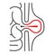 Inguinal hernia thin line icon, Human diseases concept, hernia sign on white background, Peritonitis icon in outline