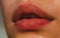 Injections, Plastic Surgery, Collagen and Beauty Treatments. Lip balm. Lipcare lipstick. Close-up of sexy lips.