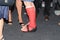 Injured foot in a cast after an accident