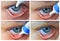 Instill eyedrops or ointment on eye