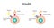 Insulin mechanism of action, regulates glucose metabolism and glucose blood level.