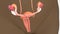 Intersection of Uterus