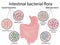 Intestinal bacteria flora. Good and bad bacterias