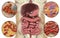 Intestinal microbiome, bacteria colonizing different parts of digestive system