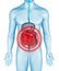 Intestinal pain on 3d illustration of male body. Intestines pain on anatomical digestive system infographic. Belly hurts illness.