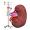 Intravenous therapy system with human kidney. Treatment of kidney disease concept, 3D rendering