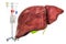 Intravenous therapy system with human liver. Treatment of liver diseases concept, 3D rendering