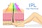 IPL light for hair removal on skin layer and woman leg.