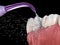 Irrigator, Water teeth cleaning. Medically accurate 3D illustration of oral hygiene