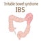 Irritable bowel syndrome IBS in a large intestine