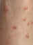 Itching caused by allergies, skin women.