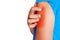 Itching of skin diseases in men using the hand-scratching. Man scratch the arm