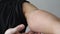 Japanese man\'s arm with rough skin