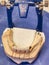 Jaw with ceramic dentures and metal prosthesis